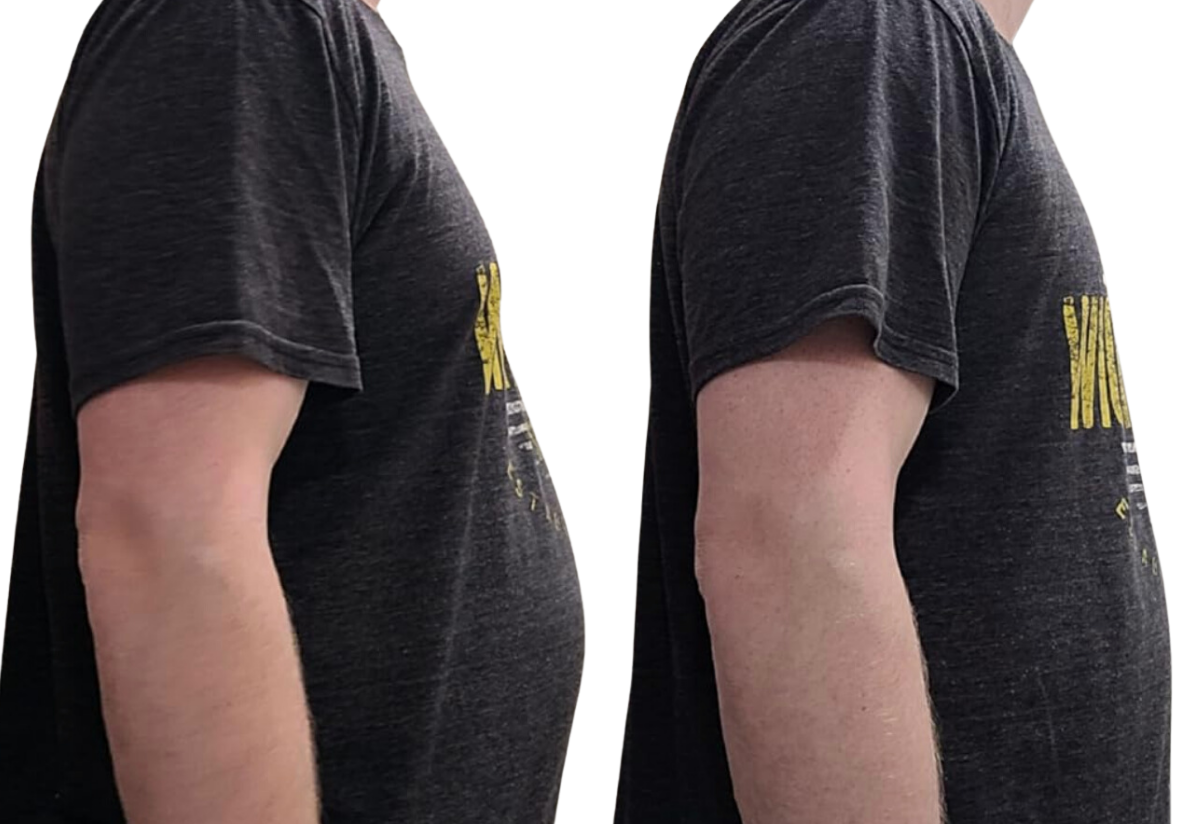 Tummy tuckers for men