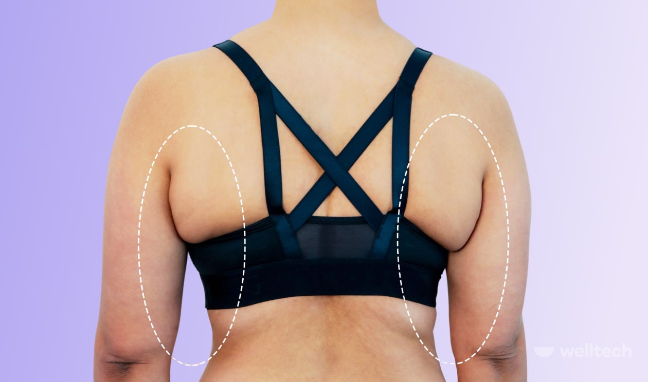 how to hide back fat using a bra