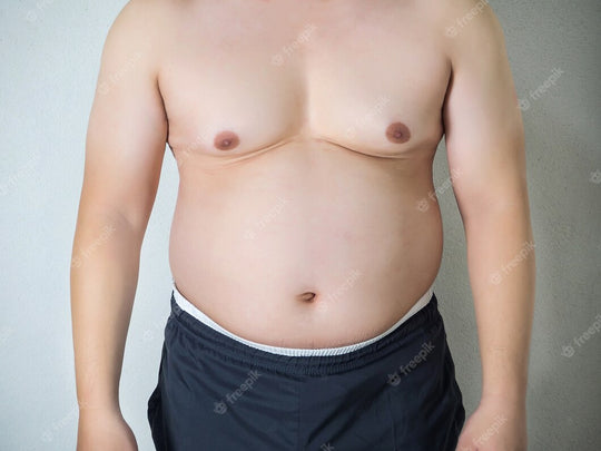 The Ultimate Guide: How to Naturally Reduce Gynecomastia and Regain Confidence